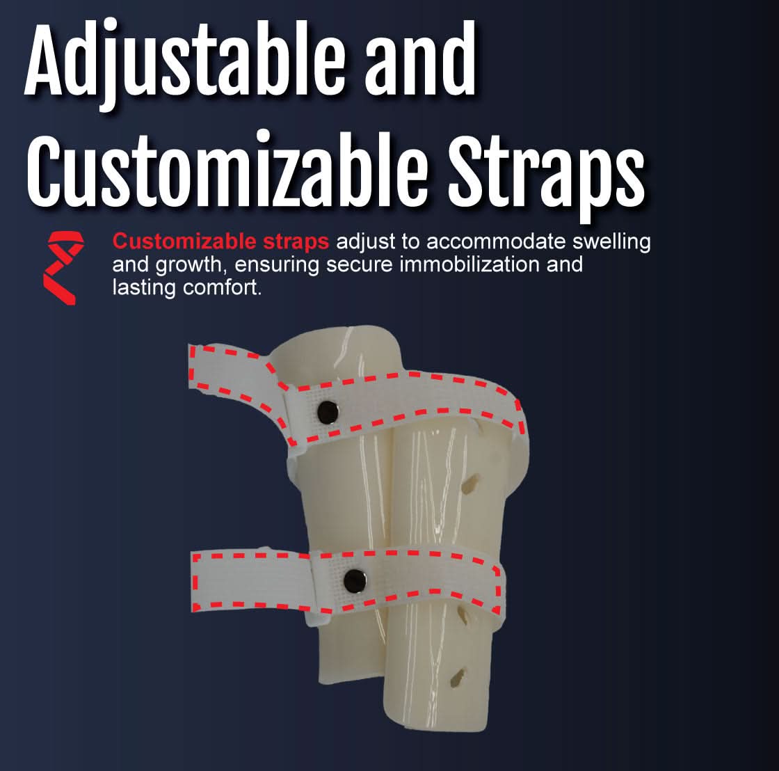 Pediatric forearm fracture orthosis in beige with gray adjustable straps outlined in red, featuring secure button fasteners, .
